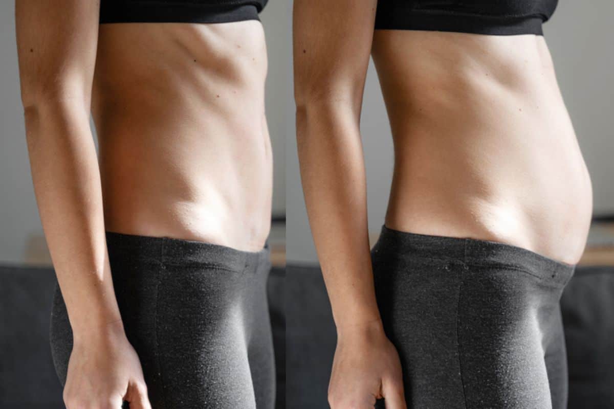 How long does diastasis recti take to improve Cardiff?