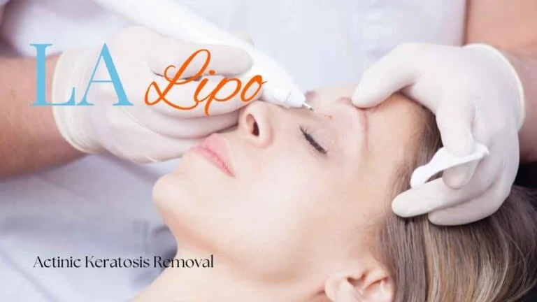 Woman receiving Actinic Keratosis Removal Treatment Cardiff
