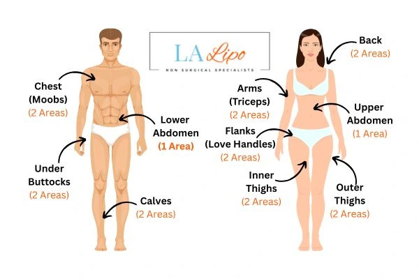 LA LIPO Cryolipolysis Areas Cardiff
