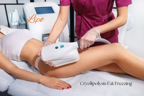 Woman receiving coolsculpting Cardiff treatment on her thighs