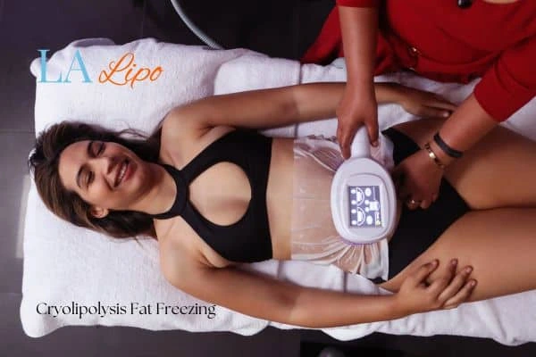 woman getting cryolipolysis Cardiff