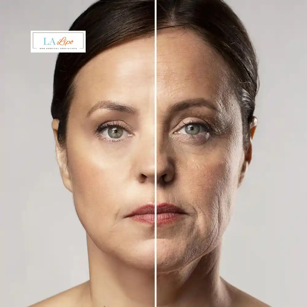 How Can You Tell If Non-Surgical Skin Tightening Is Right for You Cardiff?