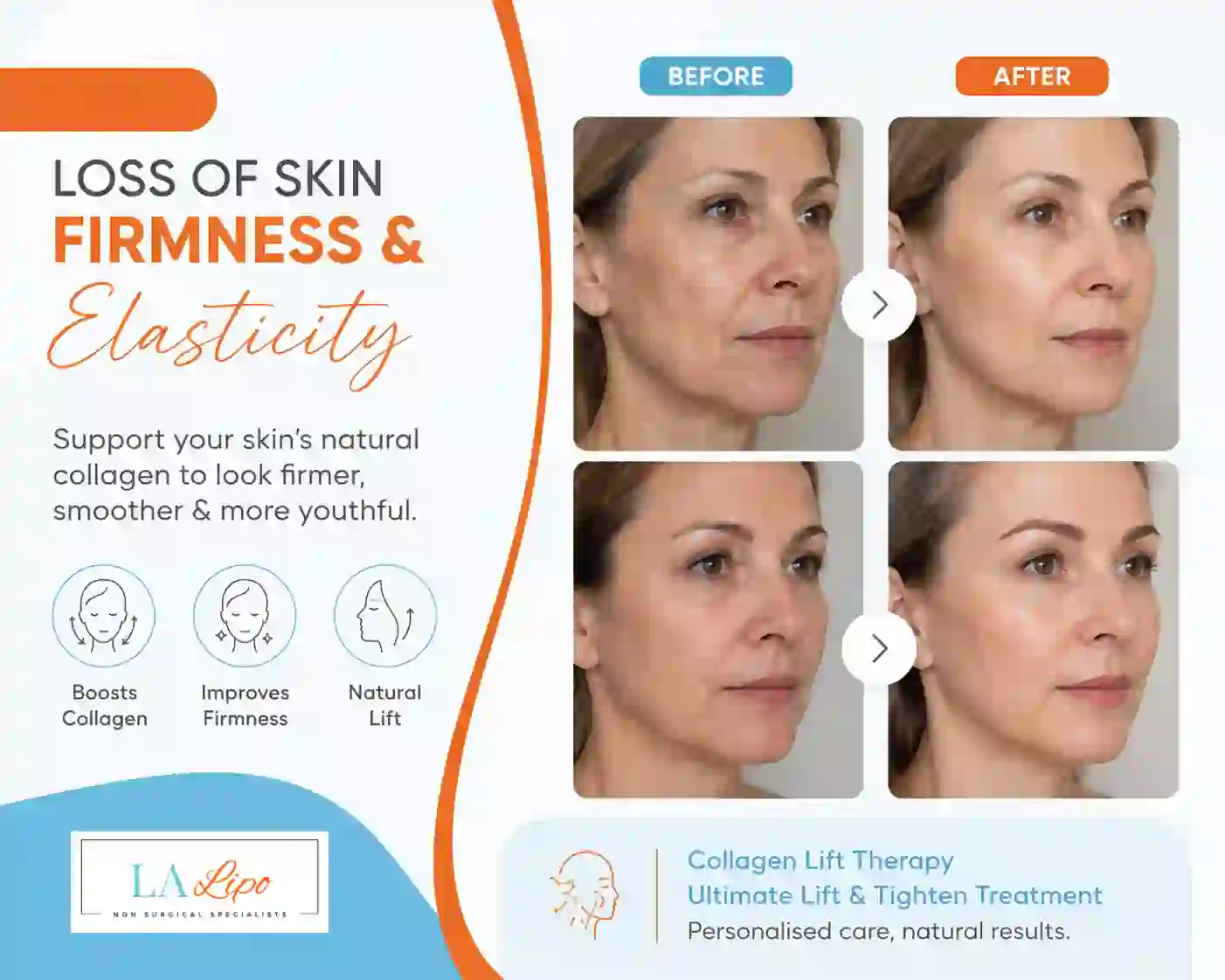 Sign #7: Loss of Skin Firmness and Elasticity Cardiff